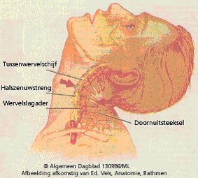 Letselschade advocaten